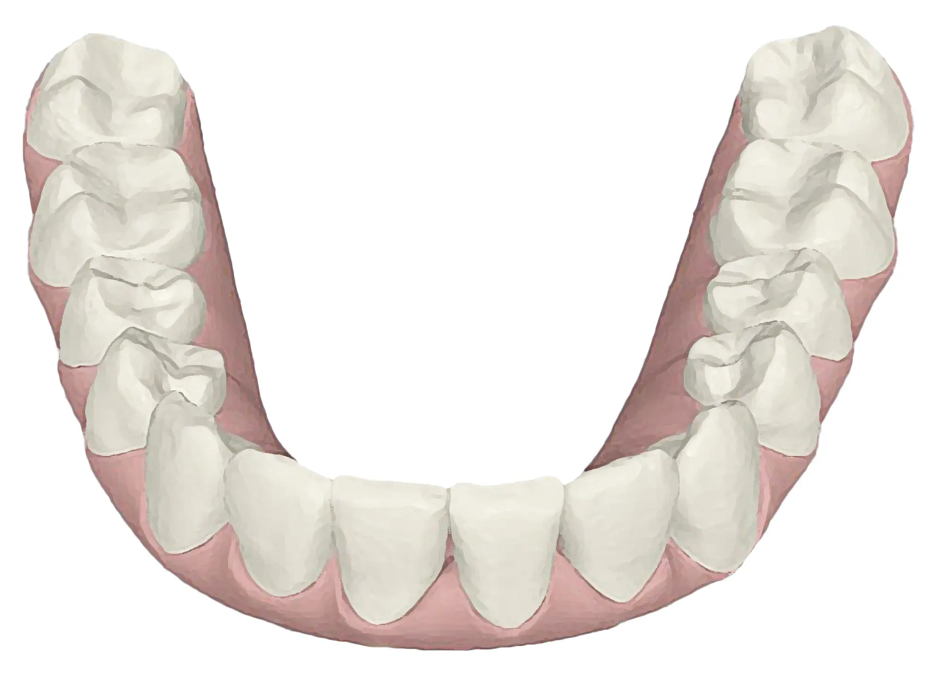 disegno dell'arcata inferiore dei denti dopo la cura con trattamento ortodontico trasparente